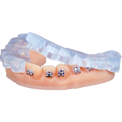 Keystone KeyOrthoModel IBT 1kg