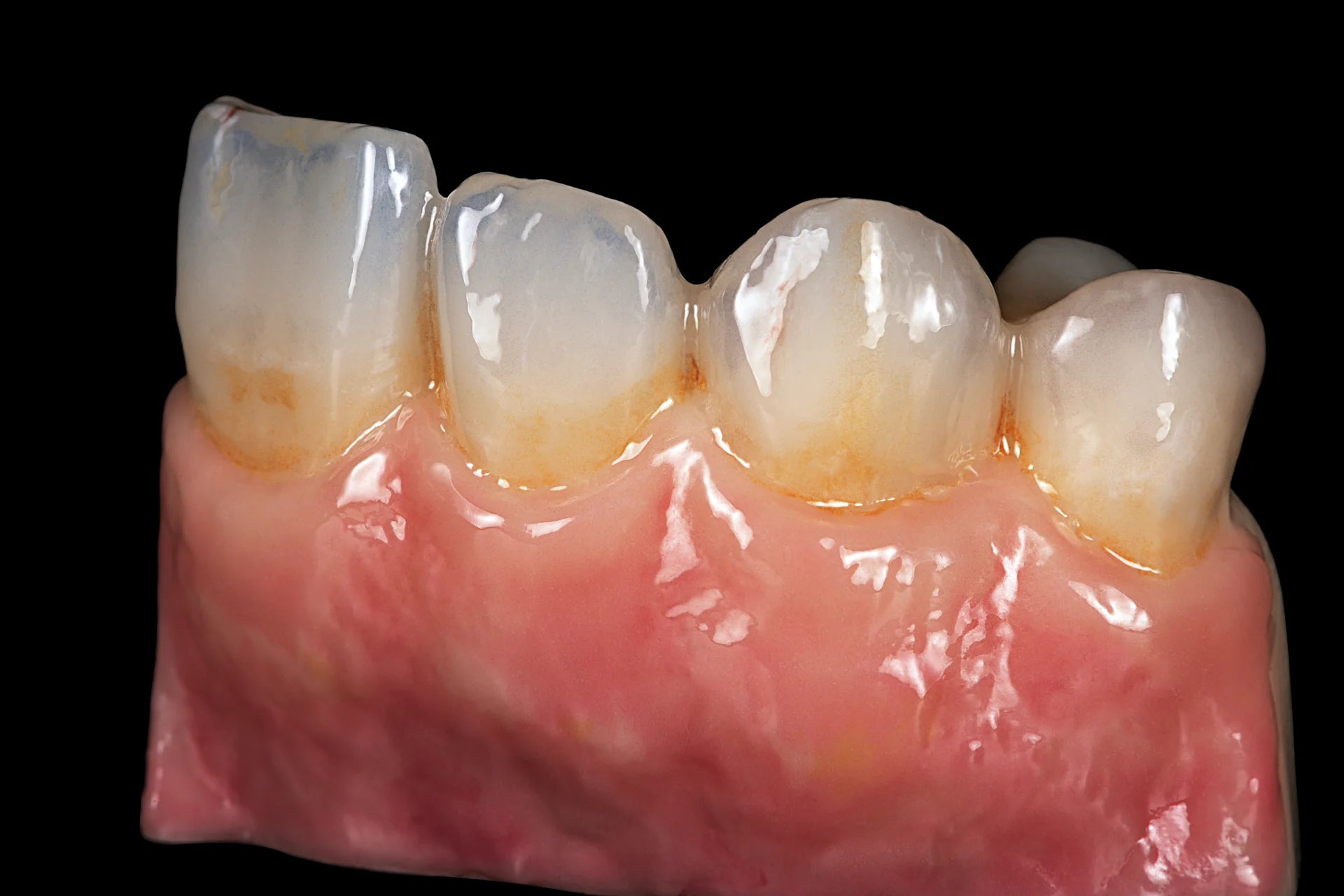 Sagemax Paint 3D Pink Esthetics Gingiva Kit