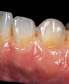 Sagemax Paint 3D Pink Esthetics Gingiva Kit