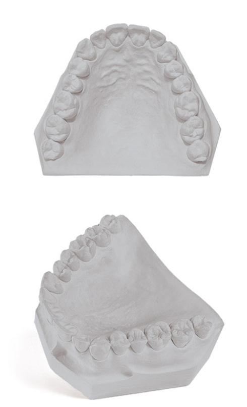 Garreco  Mouting Stone 47.5LB