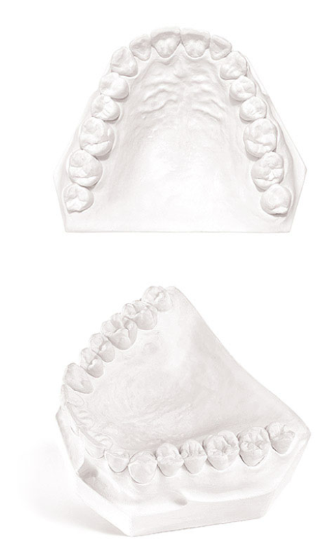 Dental Plaster