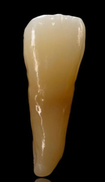 Zolid Lunaris 98x12mm