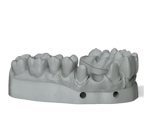 Amann Girrbach NextDent Model 2.0 / Grey for Models